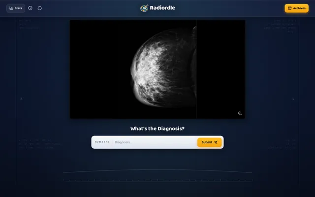 Today's Radiordle on a desktop: a mammogram in the dark workstation viewer under What's the Diagnosis?, with guess 1 of 5, a diagnosis box and Submit