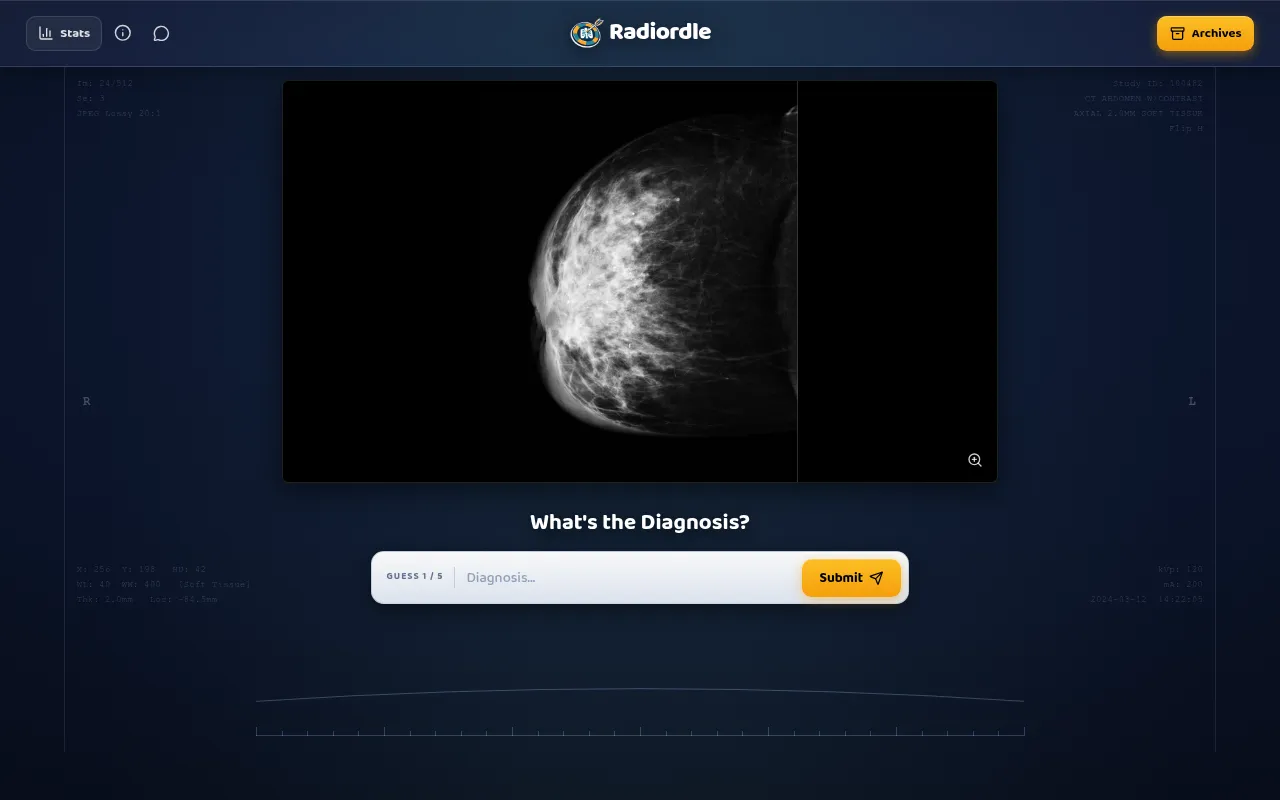 Today's Radiordle on a desktop: a mammogram in the dark workstation viewer under What's the Diagnosis?, with guess 1 of 5, a diagnosis box and Submit