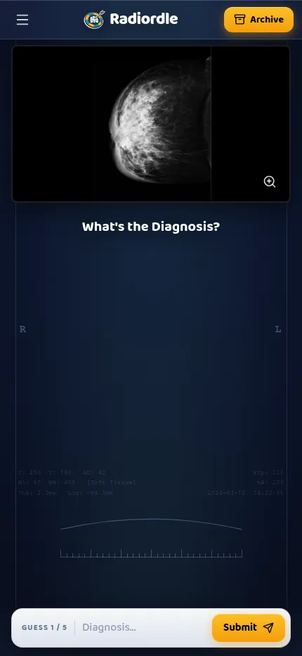 Radiordle at phone size: the day's mammogram at the top and the guess 1 of 5 diagnosis box with Submit pinned to the bottom